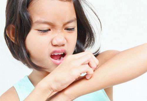 o型血是不是蚊子最喜欢吃的,蚊子是不是喜欢o型血的人