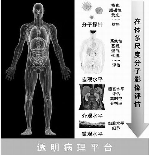 多尺度“监控”疾病动态!中国学者首次提出“透明病理”新概念