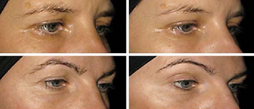 什么胶原蛋白肽的作用与功效好,胶原蛋白流失该怎么补充胶原蛋白