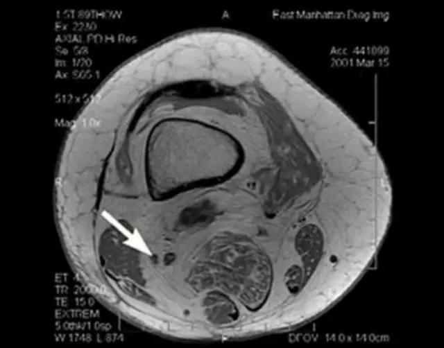 mri临床医师必读电子书,临床医生如何读mri
