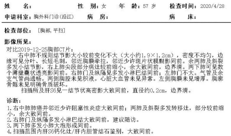 豪森药业阿美替尼治疗厄洛替尼经治T790M+肺腺癌伴脑转移病例分享