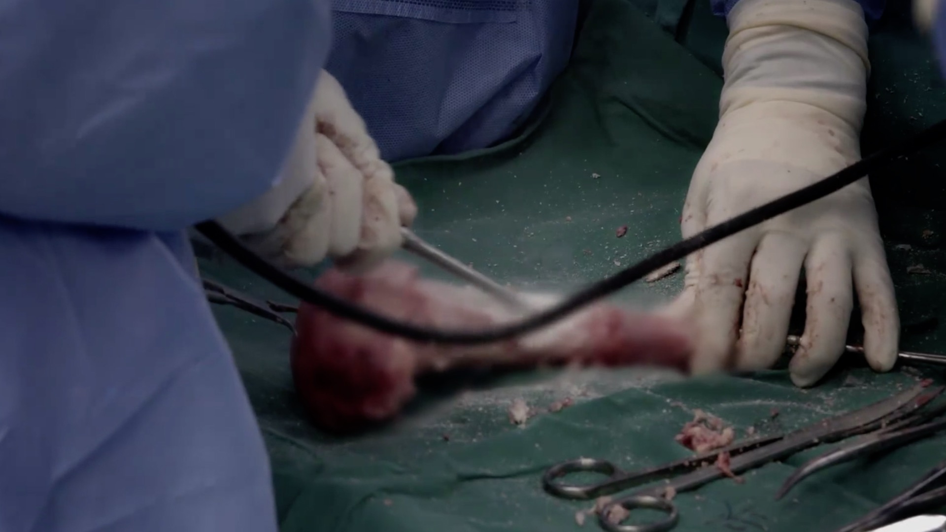 把骨头煮熟抗癌,把骨头煮熟