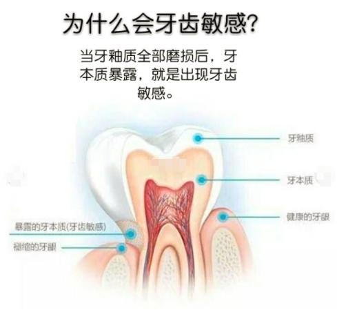 防止牙齿磨损的最佳方法,保留牙根的牙齿修复治疗
