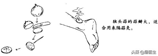 艾灸专家讲艾灸疗效,在家艾灸哪种灸法效果最好