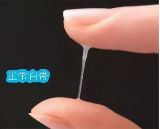 到底什么样才是“好白带”呢？