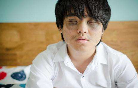 罗志祥的黑眼圈到底是怎么回事,罗志祥为什么黑眼圈很重