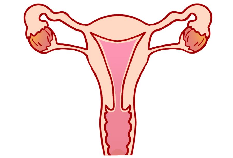 朱迅生病真相揭秘,朱迅艾灸