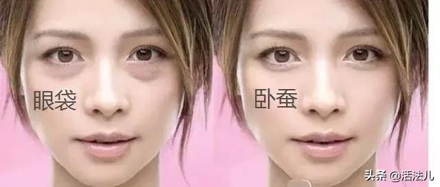 能快速解除眼袋的方法推荐,祛眼袋最快的恢复方法