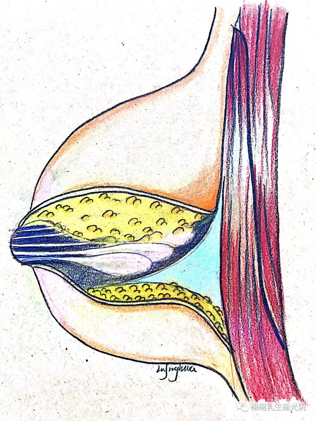 预防乳房下垂健胸操,怎样预防产后乳房下垂