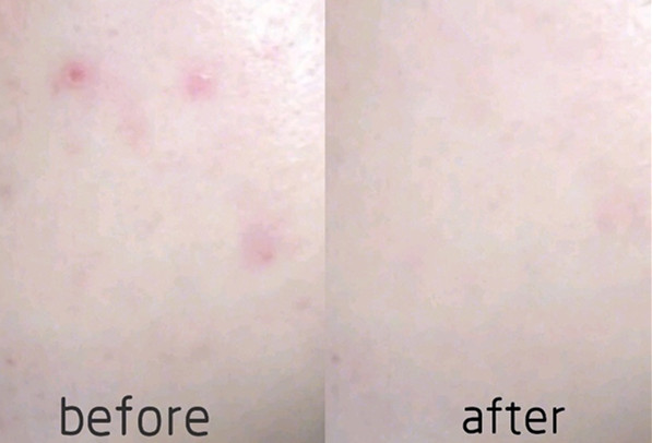 花了3000祛斑没效果怎么办,花了三万买的东西