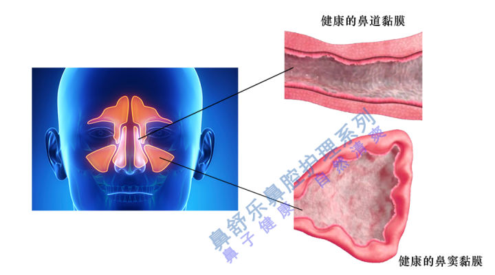现在怎么那么多鼻炎馆,专门的鼻炎馆管用吗
