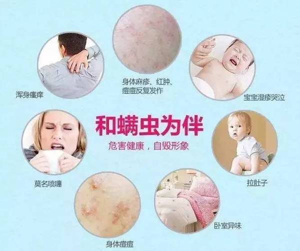 螨虫的最佳防治方法,螨虫感染的症状表现