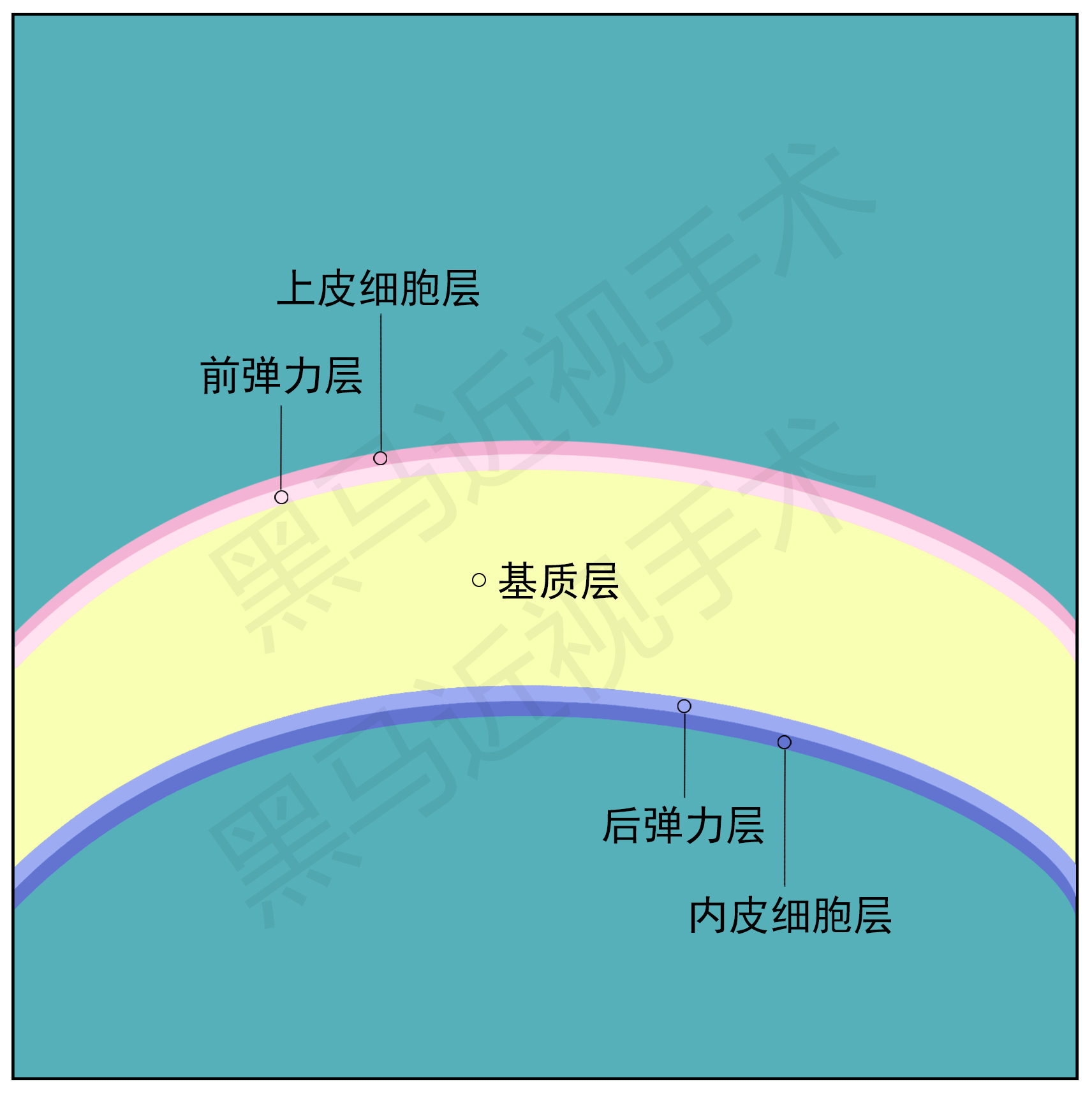 近视300度做激光手术会有后遗症吗,激光近视手术的后遗症有哪些知乎
