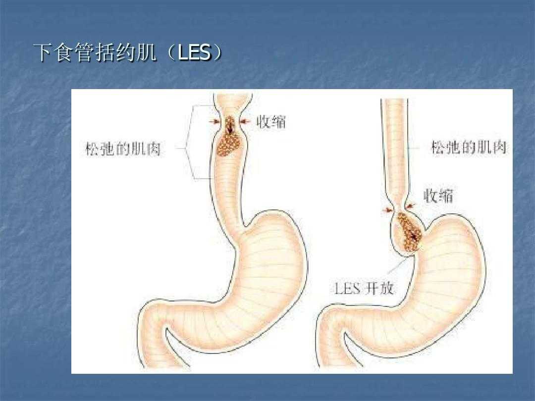 poem手术一年后复发,poem手术后复发率