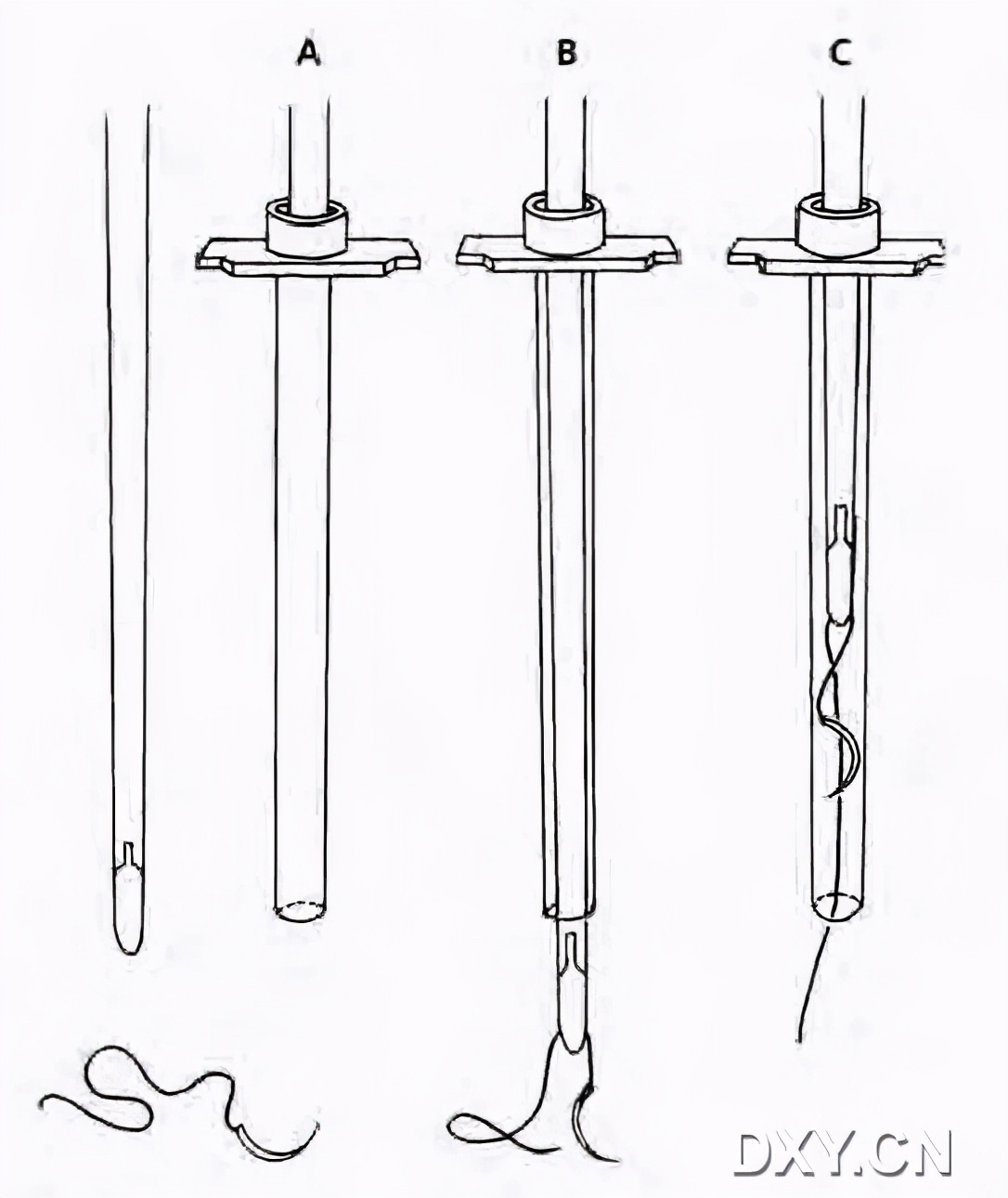 实用大全：腹腔镜下缝合与打结