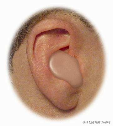 耳朵游泳进水引起中耳炎怎么处理,游泳耳朵进水中耳炎怎么处理