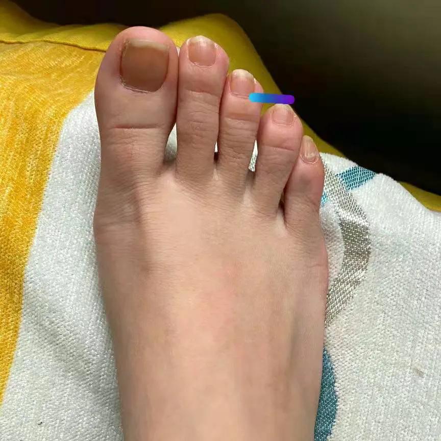 治疗肠胃的脚部穴位,肠胃理疗手法课程