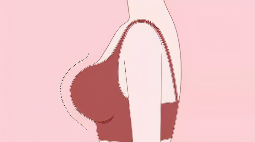 假体隆胸怎么选择合适的假体,隆胸假体怎么样