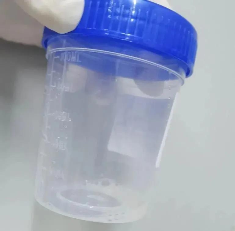 怎么判断液体有没有酒精,怎样才能检测出液体所含成分