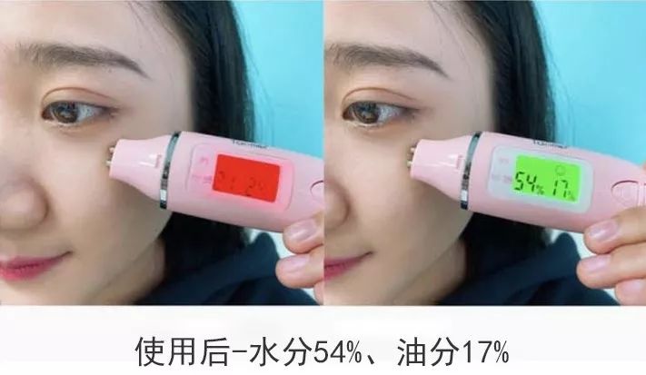 眼部细纹去皱的方法,眼角皱纹多用什么抗皱纹