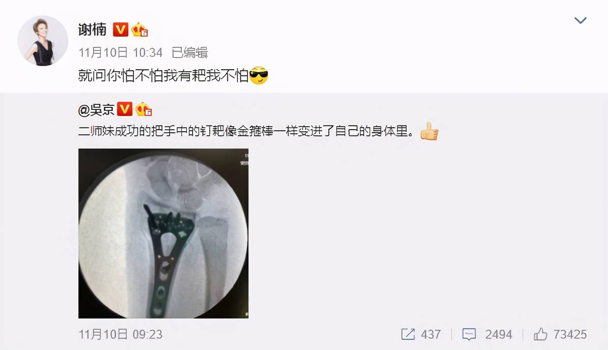 谢楠桡骨粉碎性骨折手术后锻炼,谢楠桡骨骨折怎么康复