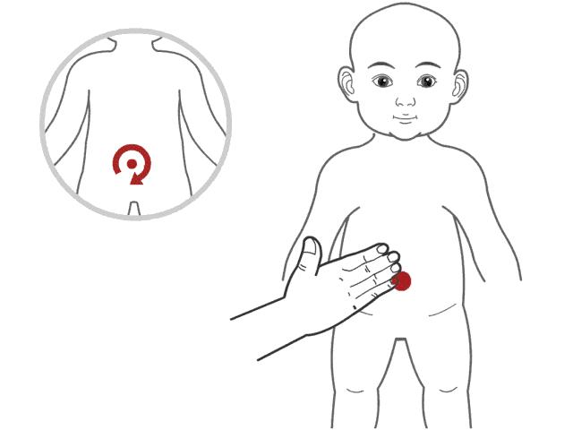 小儿推拿治疗宝宝脾胃疾病,值得收藏