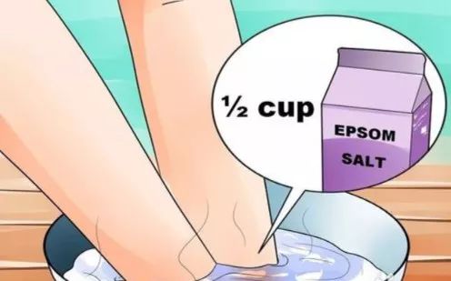 怎么预防跑步起水泡,一到夏天跑步脚就起泡怎么办