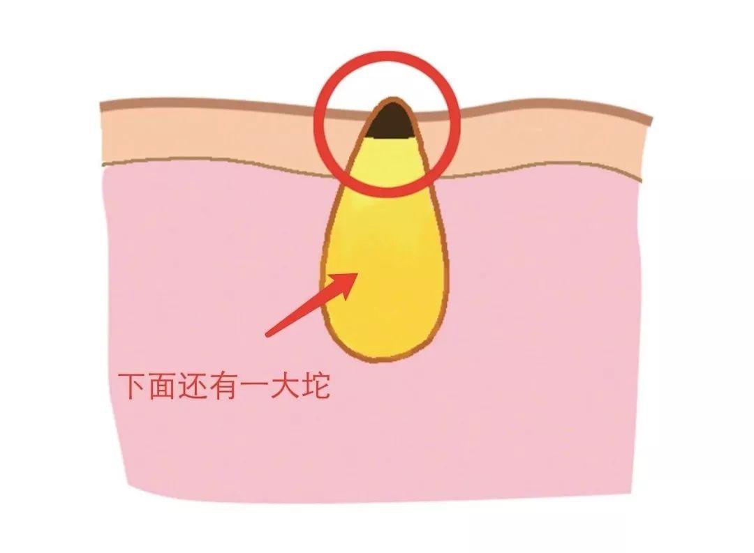 这些不靠谱的护肤方式你可别乱试,这些烂脸护肤误区你可千万不要犯