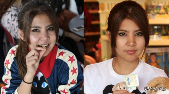 18岁土肥圆豪掷800万全身整形，鼻子6次大整假体穿出，效果却超美