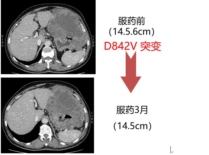 基因检测靶向药副作用,癌症靶向药的基因检测怎么做