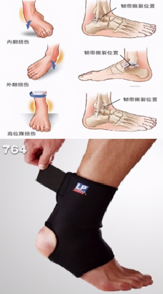 青少年常见运动伤害的处理方式,儿童常见运动损伤的正确处理