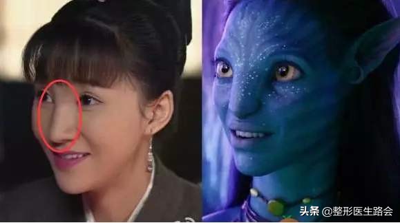 鼻整形手术风险,鼻整形副作用