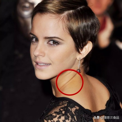 懒人最简单快速的去颈纹方法,颈纹难看去不掉试试这个方法