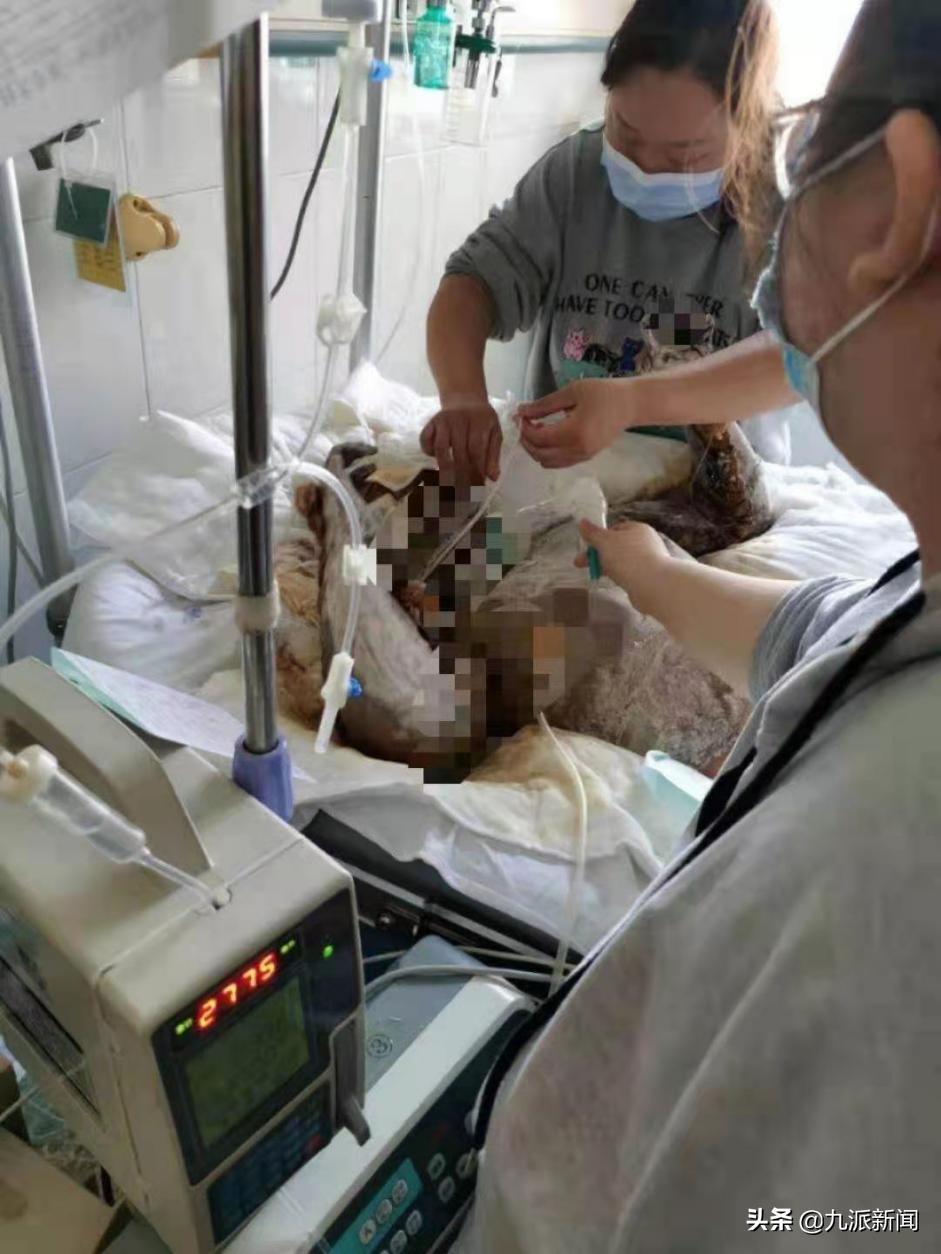 男子泼油烧伤女友,河南一男子泼汽油烧伤女友