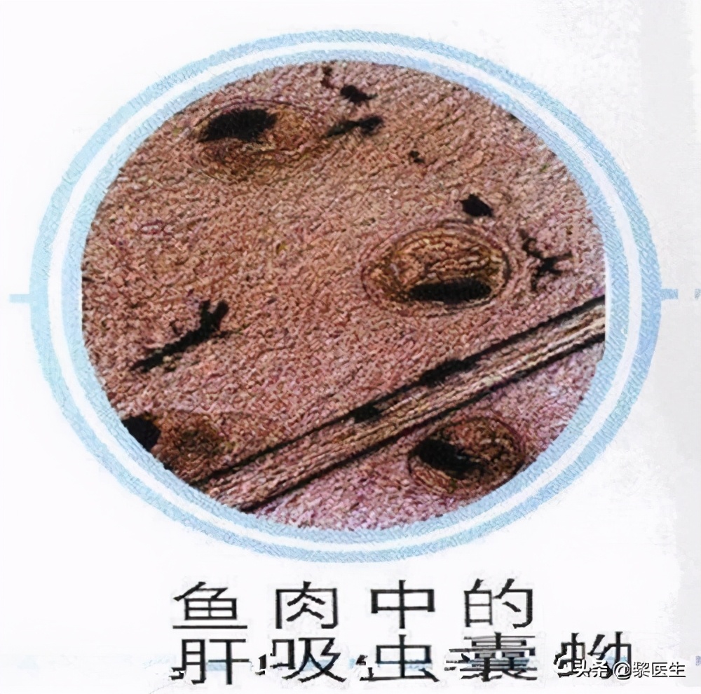 患有肝吸虫有什么症状,羊肝吸虫的征兆