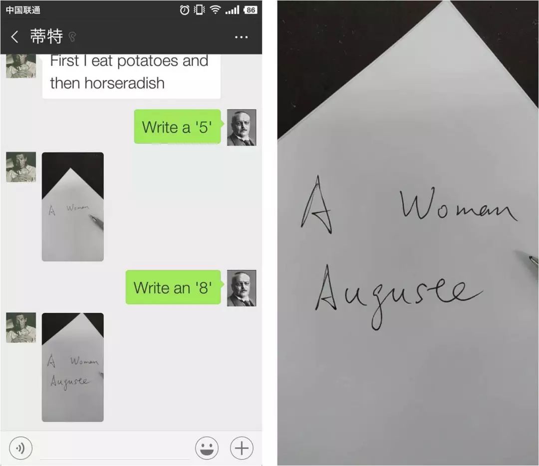 阿尔茨海默病寿命都超不过10年,百年阿尔茨海默病