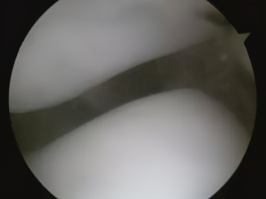 不同部位膝关节,骨科医生教你一招搞定膝盖痛