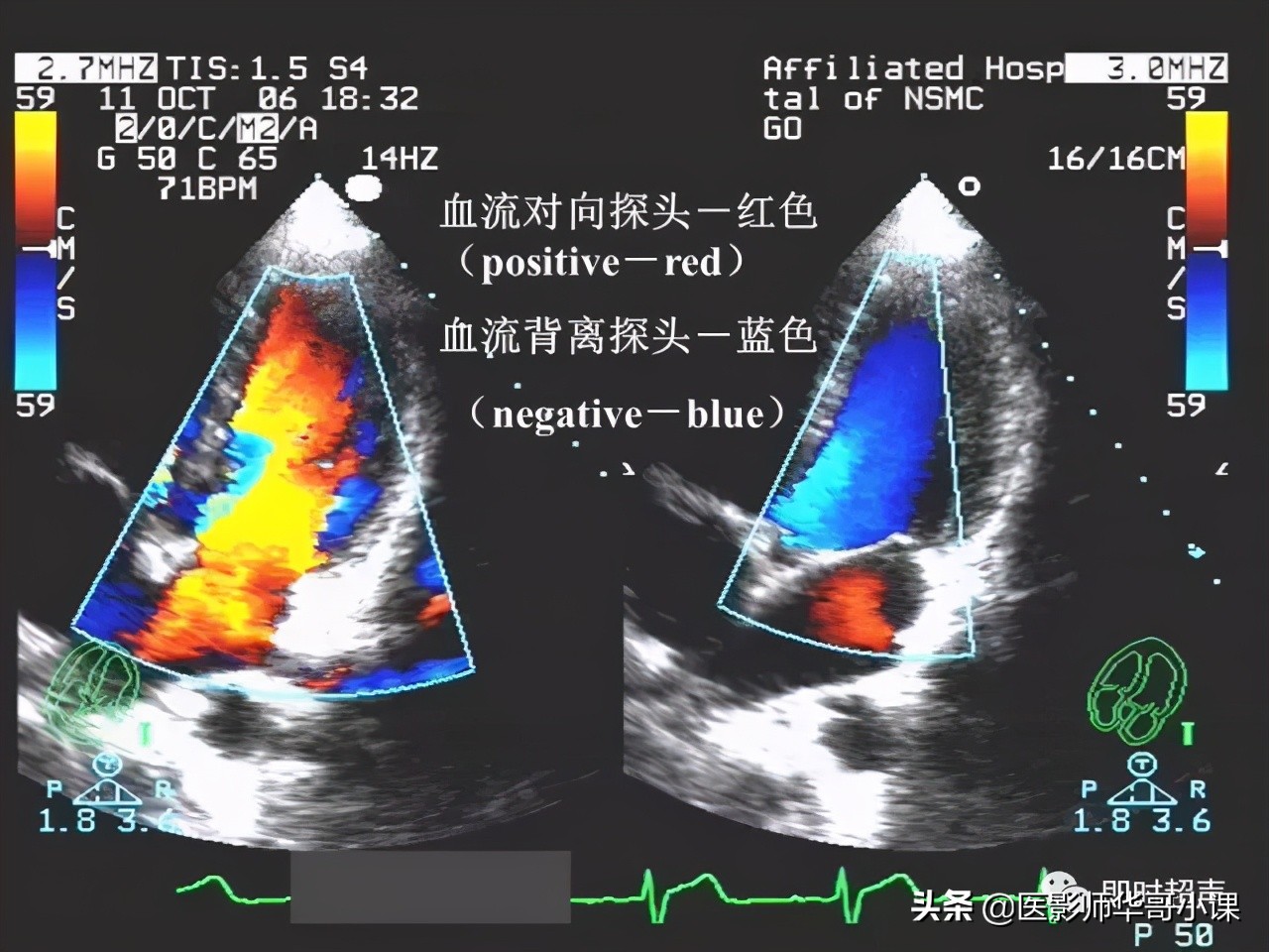 超声检查报告单讲解,超声图像检查