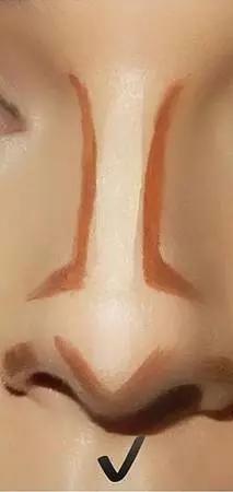 鼻头大怎么改善变小,鼻子不好看怎么办隆鼻