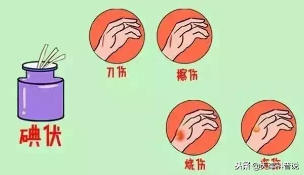 健康养生｜紫药水、红药水、酒精、碘伏……哪种处理伤口好？