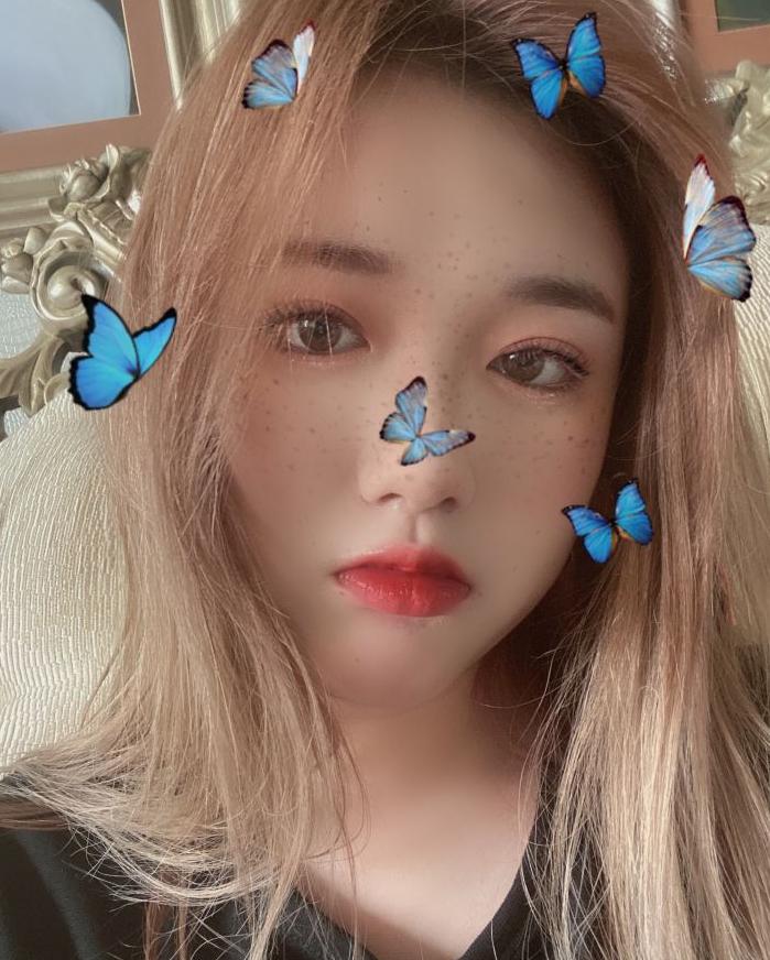 全切提肌案例,姐妹们做全切双眼皮都多少钱