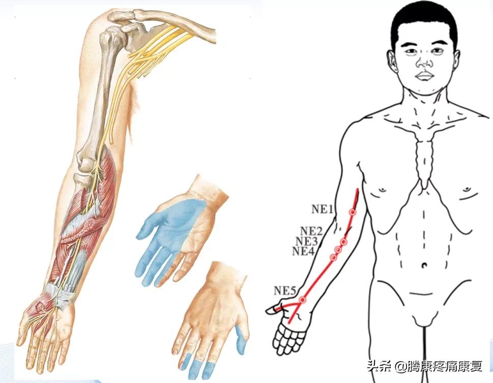 反射痛和牵涉痛,牵涉痛的特点