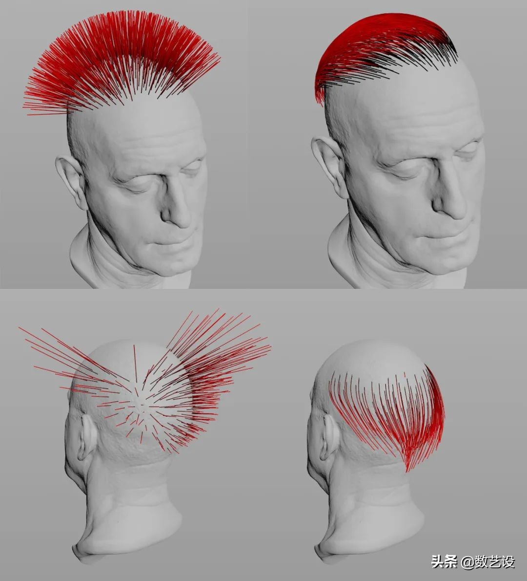 3d防脱发动画,毛发生长3d动画