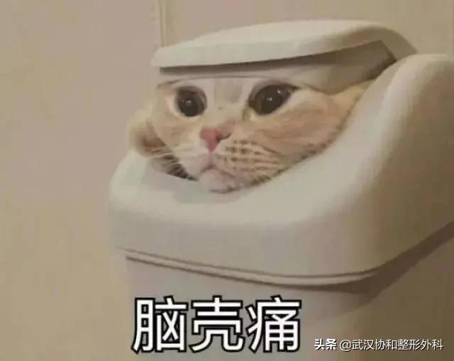 植发的十大潜规则,植发快问快答