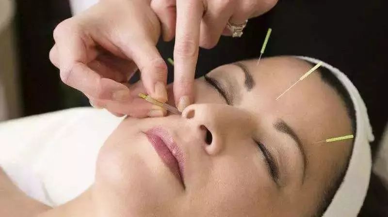 去除鱼尾纹抬头纹法令纹打什么针,有鱼尾纹和法令纹适合做什么医美