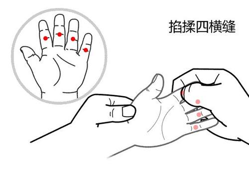 积食上火咳嗽吃什么好,小儿积食上火咳嗽吃什么药