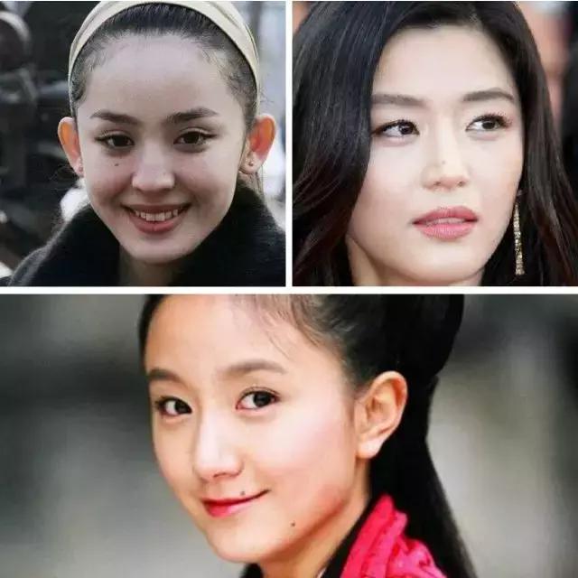 孩子的痣会恶变吗,孩子身上长痣会癌变吗