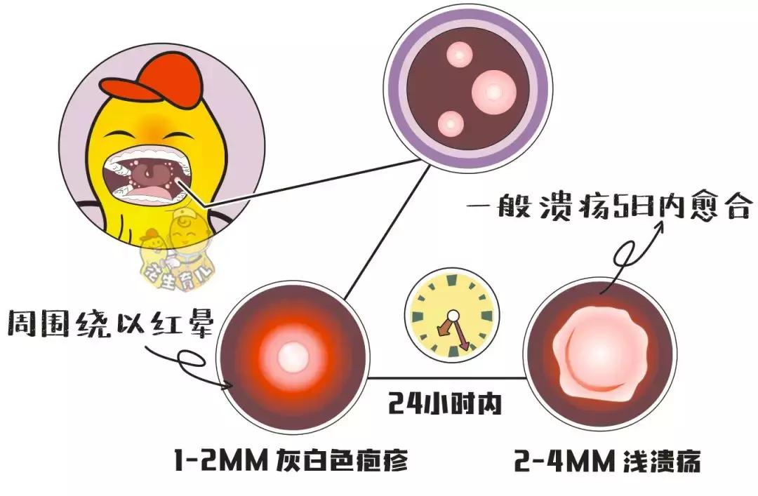 手足口疾病预防知识,手足口疾病预防方法