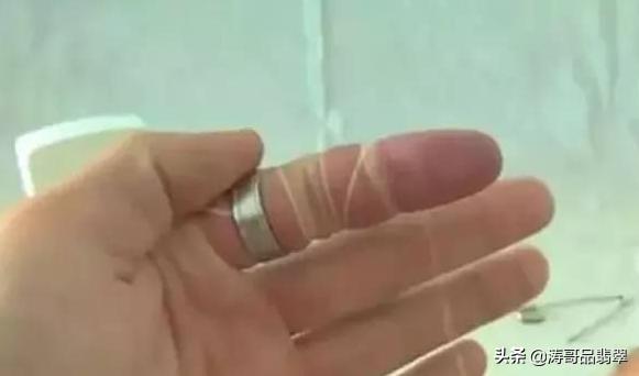 戒指戴手上摘不下来最快速的办法,戒指摘不下来用线摘是什么原理