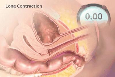 哈尔滨产后修复中心，带大家认识一下您身体的“三大管家”